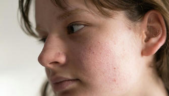 What Happens If You Stop Washing Your Face?