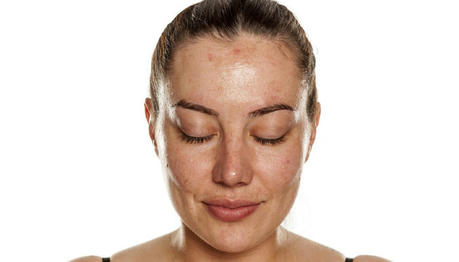 What Your Skin Is Telling You About Your Health